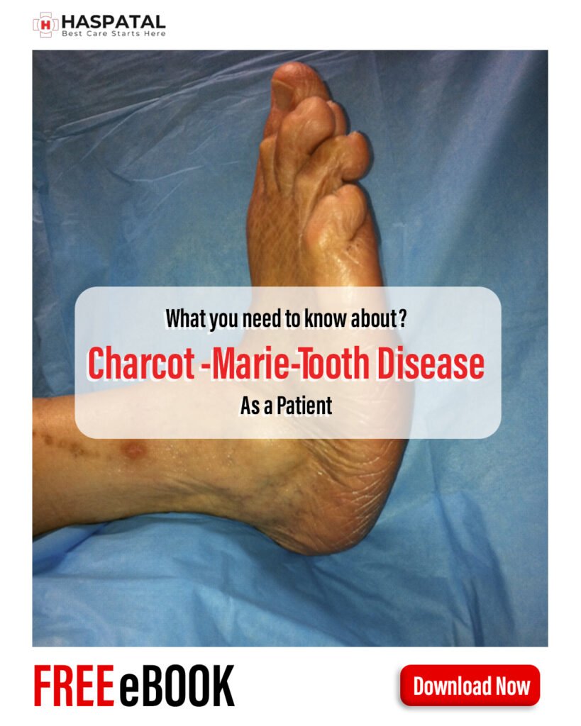 How charcot marie tooth disease can affect your health? Haspatal online consultation app