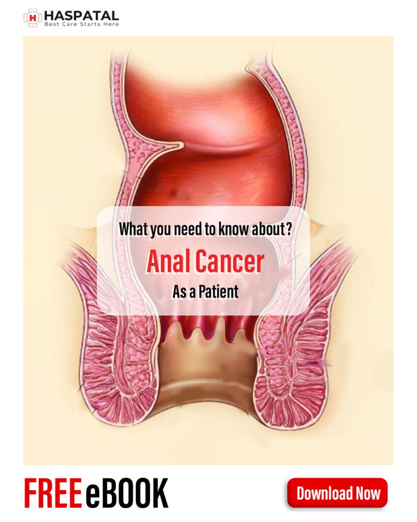 How anal cancer can affect your health? Haspatal online consultation app