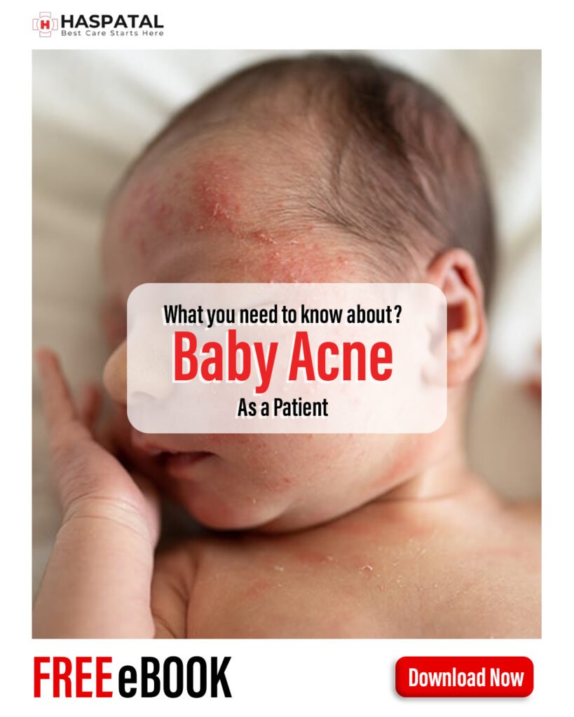 Baby Acne and its Symptoms- Haspatal online consultation app