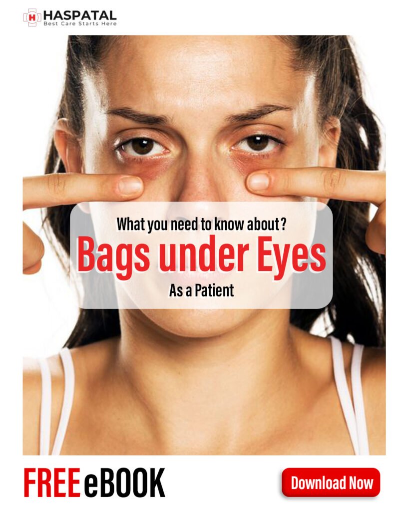How bags under eyes can affect your eyes? Haspatal online consultation app