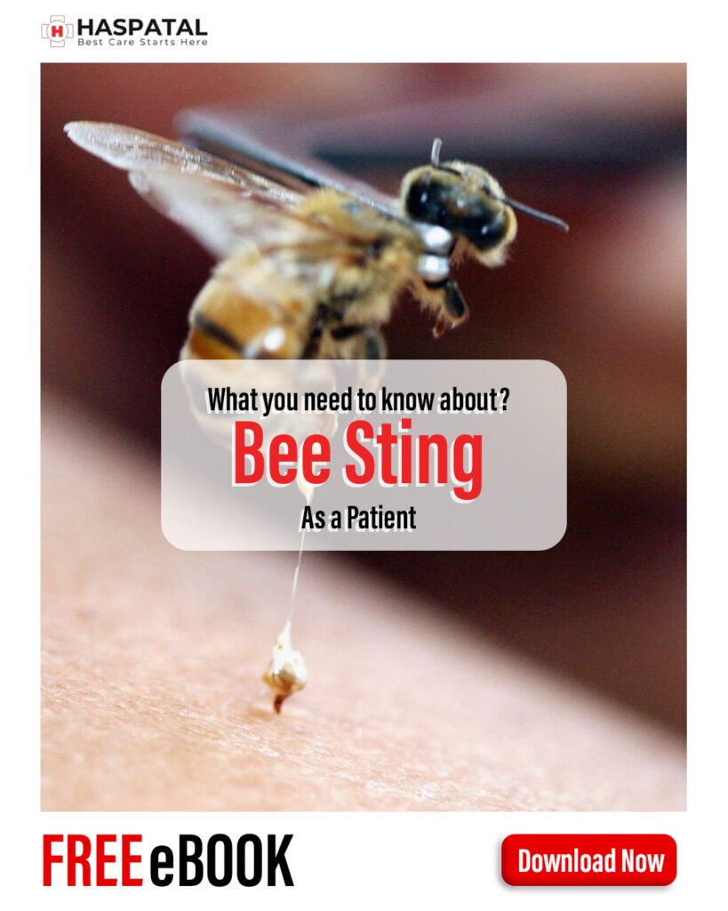 How bee sting can affect your health? Haspatal online consultation app