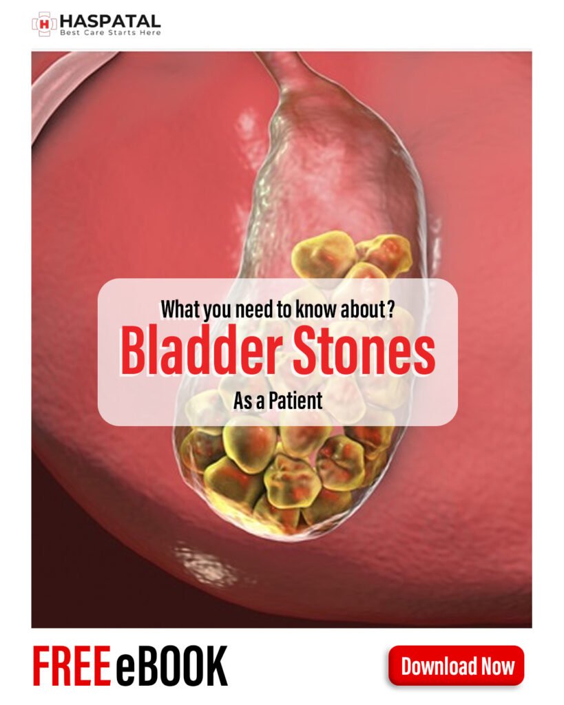 Bladder Stones and Symptoms - Haspatal online consultation app