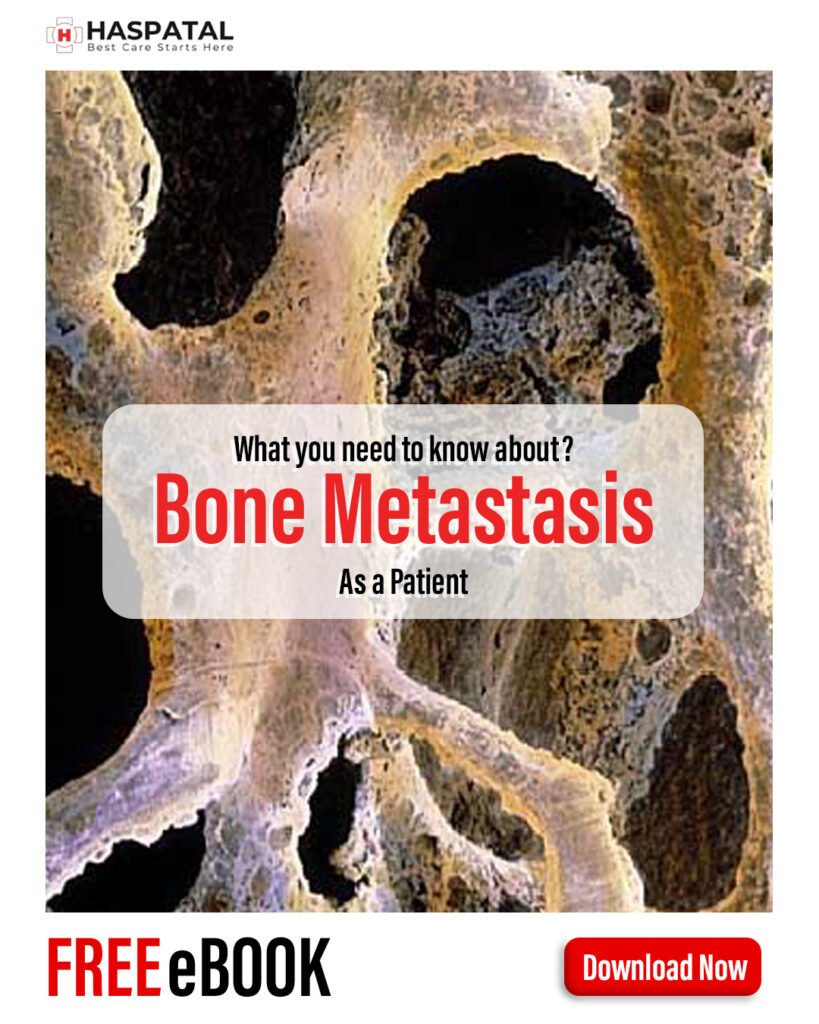 Bone Metastasis and its Symptoms - Haspatal online consultation app.