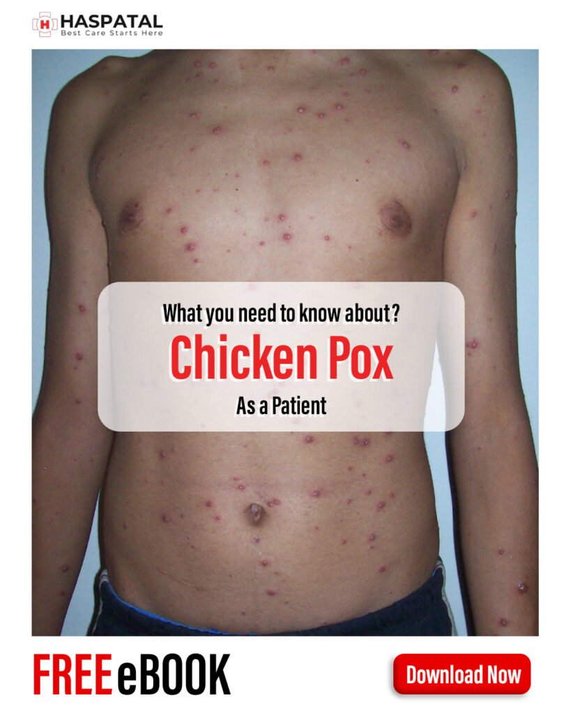 How chicken pox can affect your health? Haspatal online consultation app.