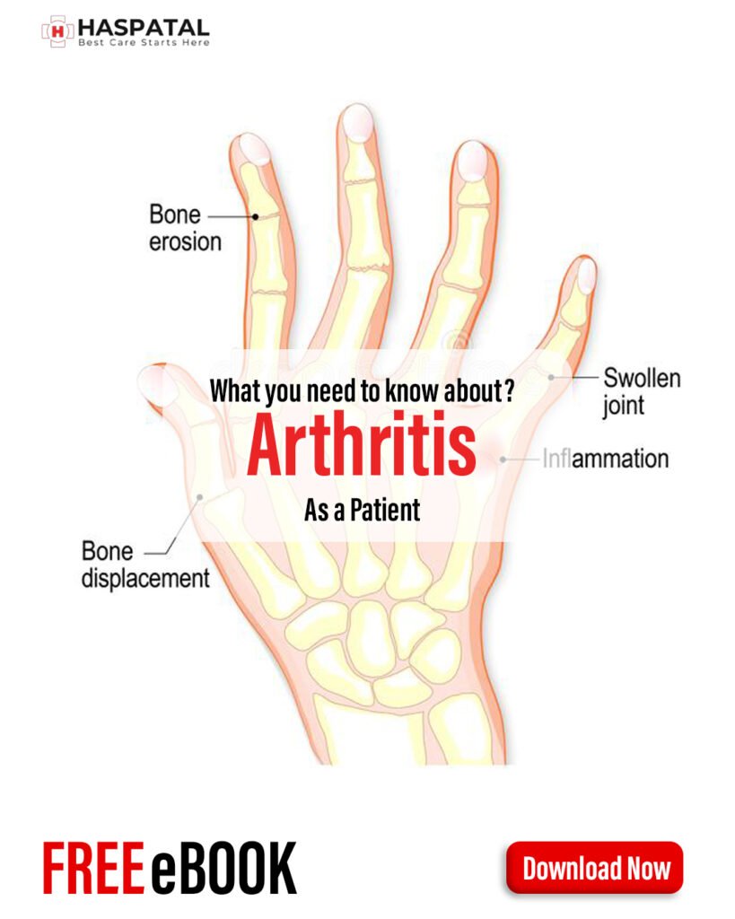 How arthritis can affect your health? Haspatal online consultation app