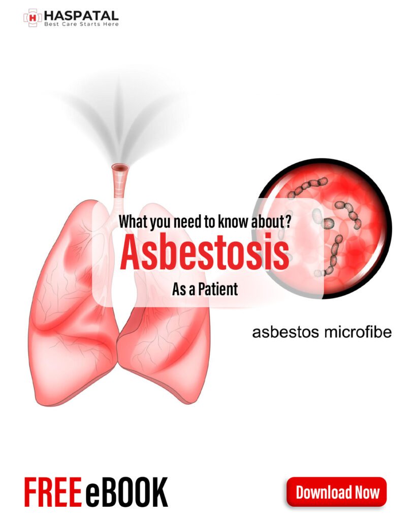 How asbestosis can affect your health? Haspatal online consultation app