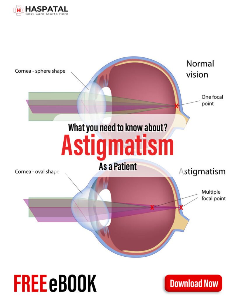 How astigmatism can affect your health? Haspatal online consultation app
