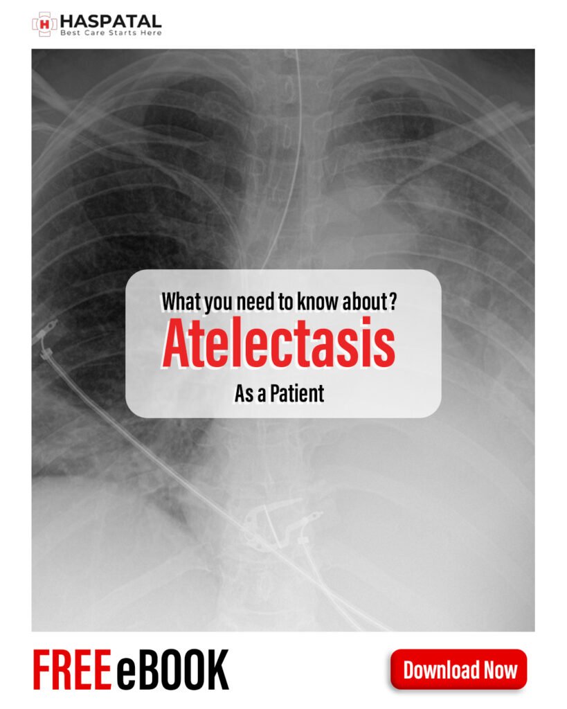 How atelectasis can affect your health? Haspatal online consultation app