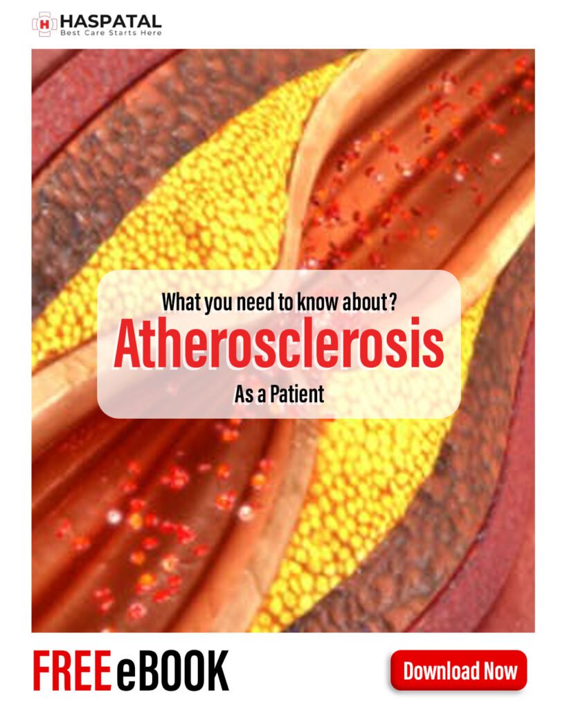 How atherosclerosis can affect your health? Haspatal online consultation app