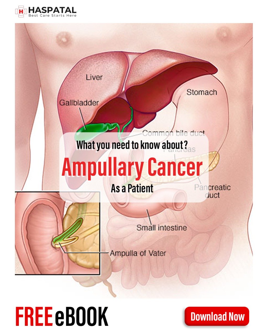 How Ampullary Cancer Can Affect Your Health Haspatal App