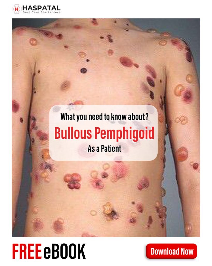 How bullous pemphigoid can affect your health? Haspatal online doctor consultation app.