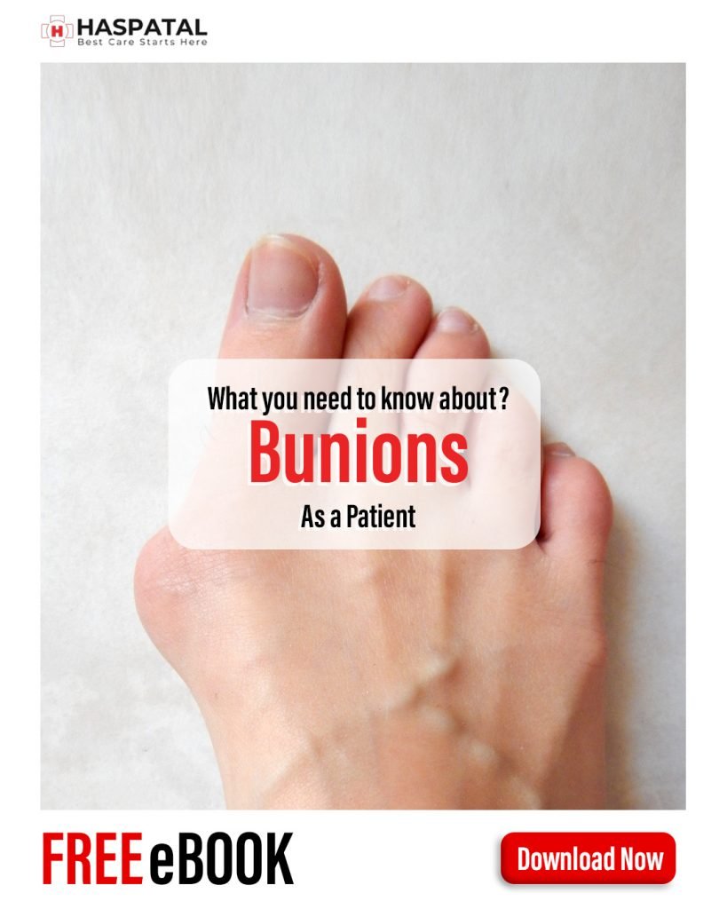 How bunions can affect your health? Haspatal online doctor consultation app