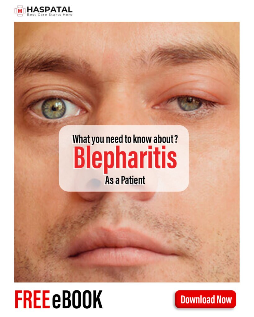 How blepharitis can affect your health? Haspatal online consultation app