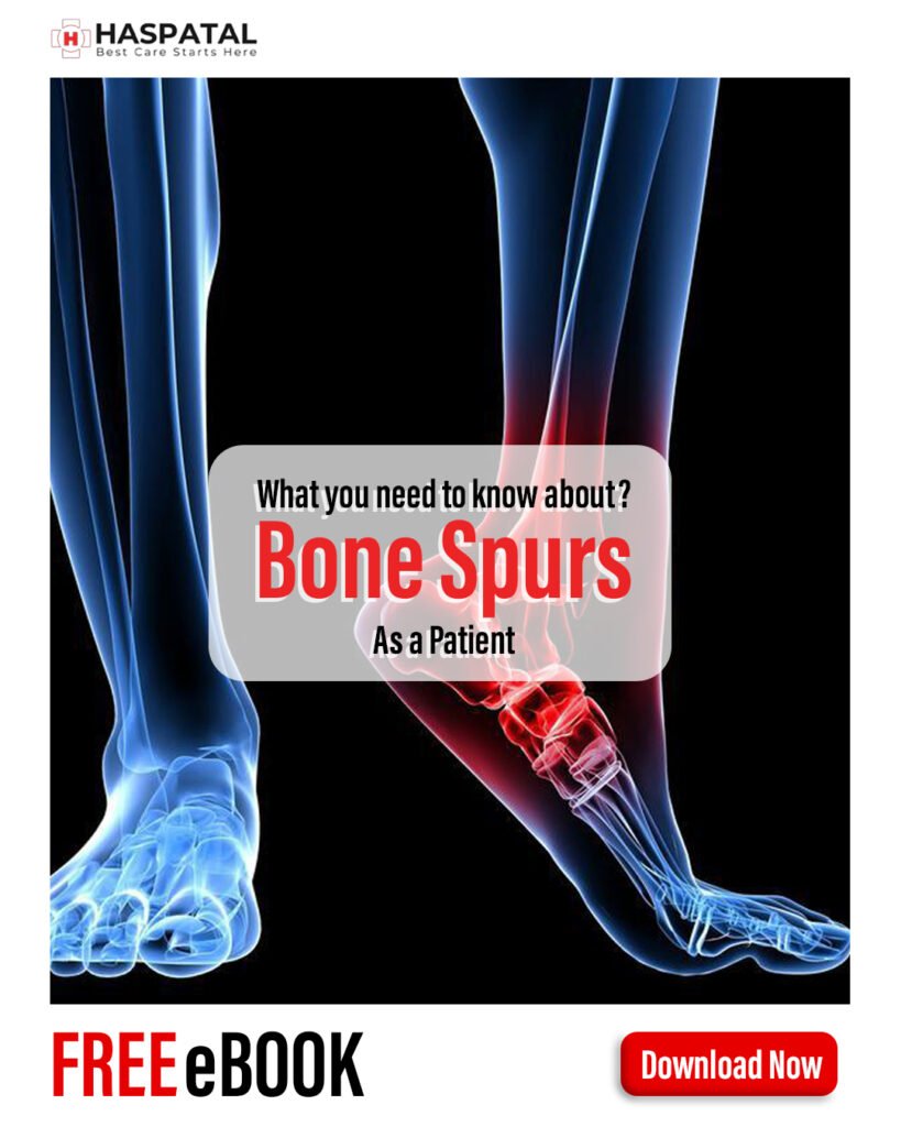 How bone spurs can affect your health? Haspatal online consultation app