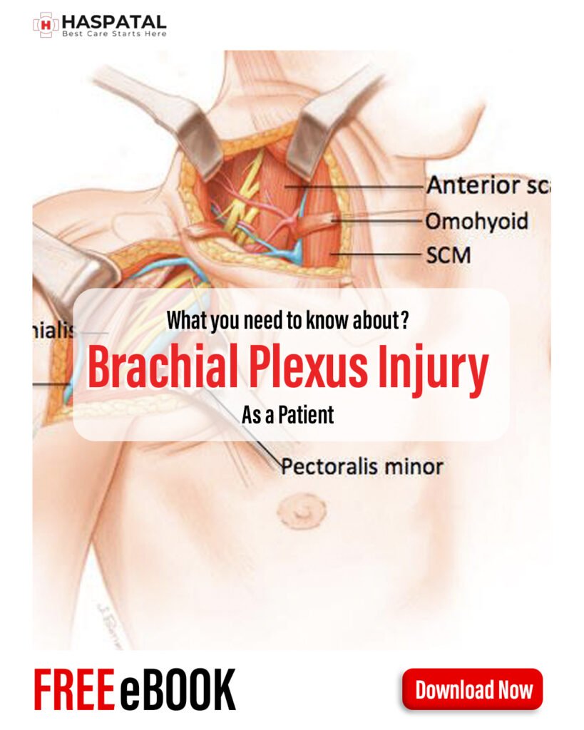How brachial plexus injury can affect your health? Haspatal online consultation app