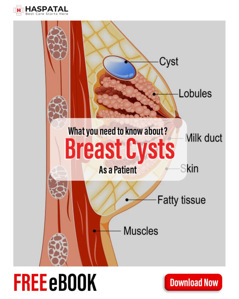 How breast cysts can affect your health? Haspatal online consultation app