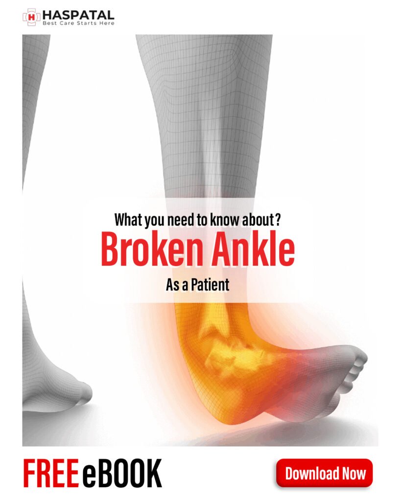 How broken ankle can affect your body? Haspatal online consultation app