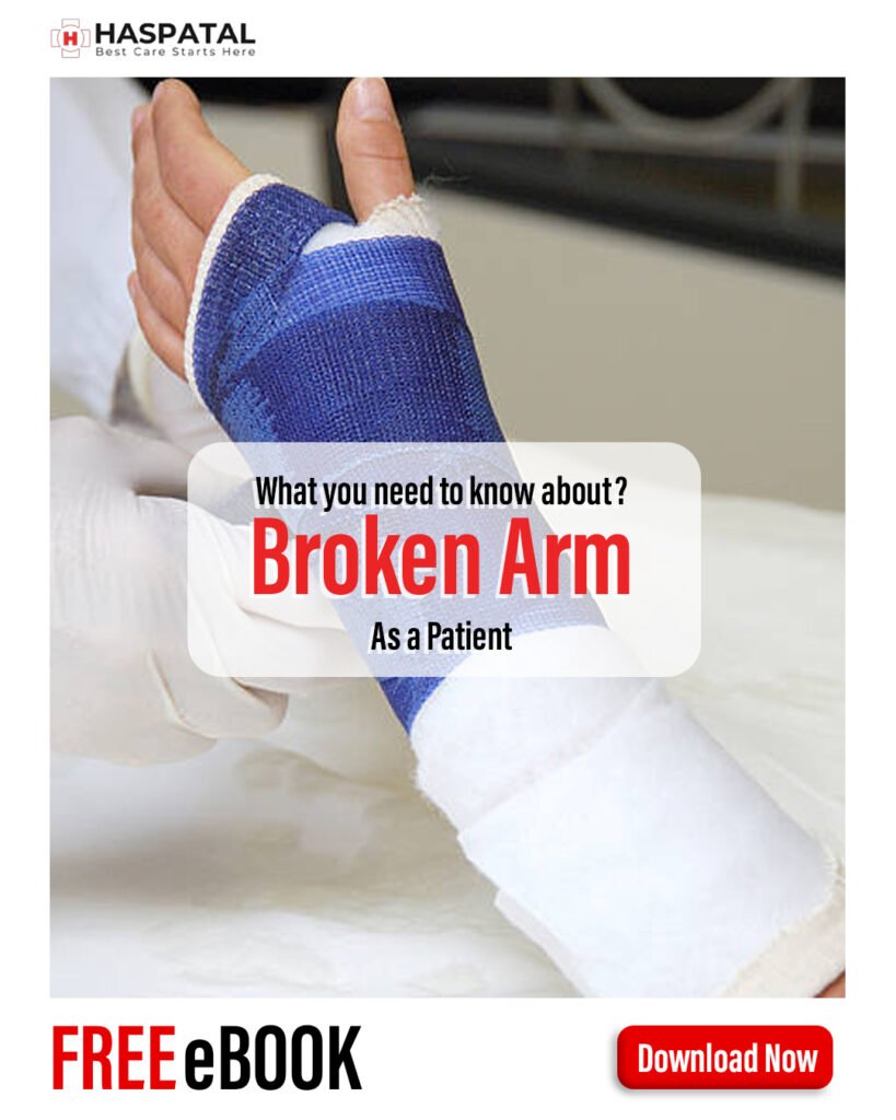 How broken arm can affect your body? Haspatal online consultation app