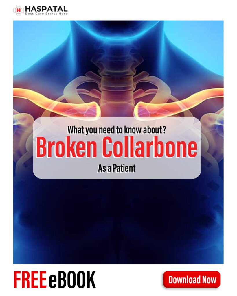How broken collarbone can affect your body? Haspatal online consultation app