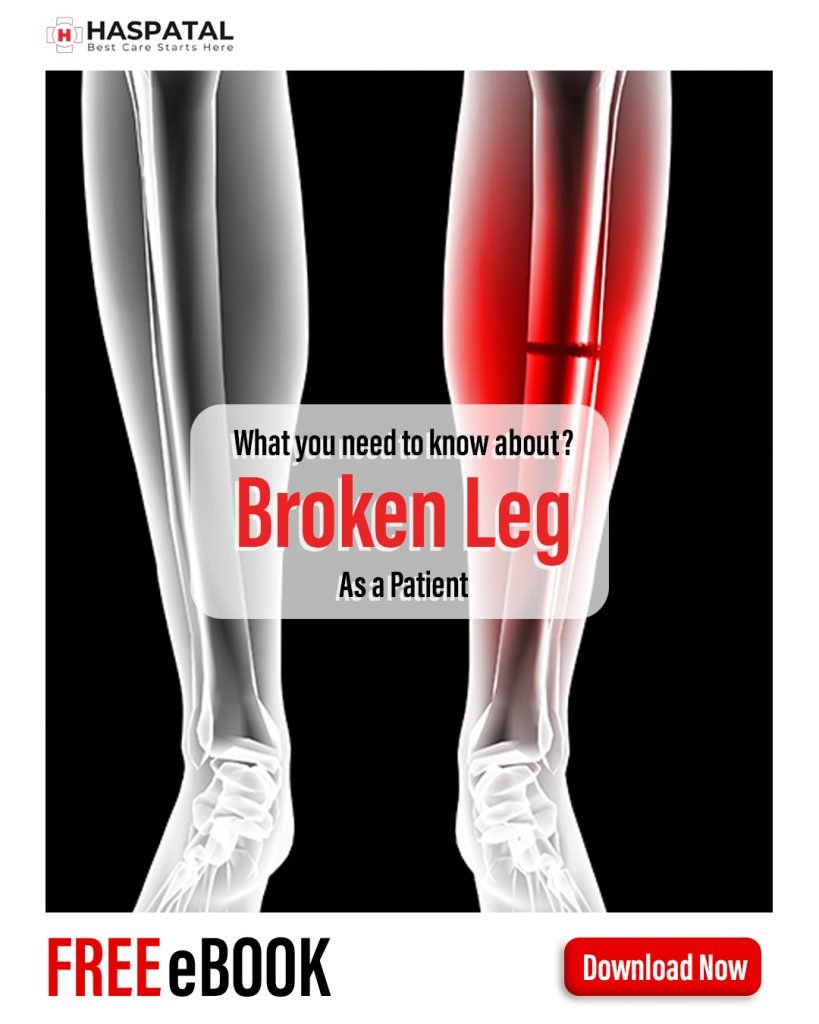 How broken leg can affect your body? Haspatal online consultation app