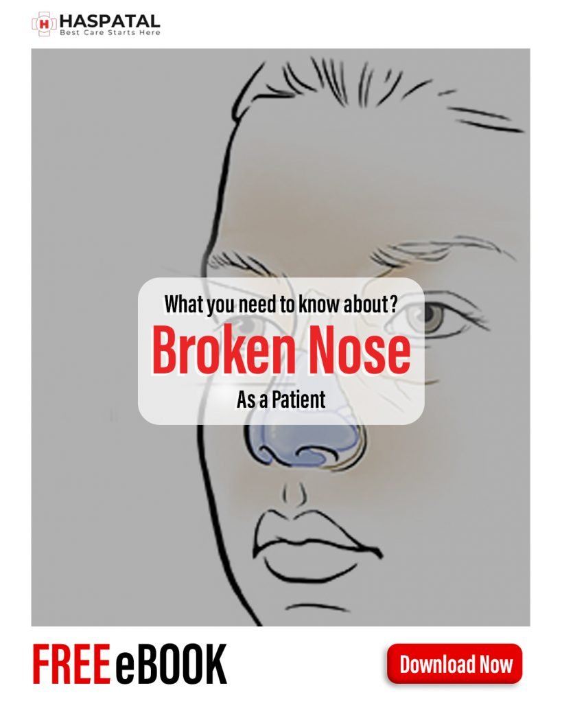 How broken nose can affect your body? Haspatal online consultation app