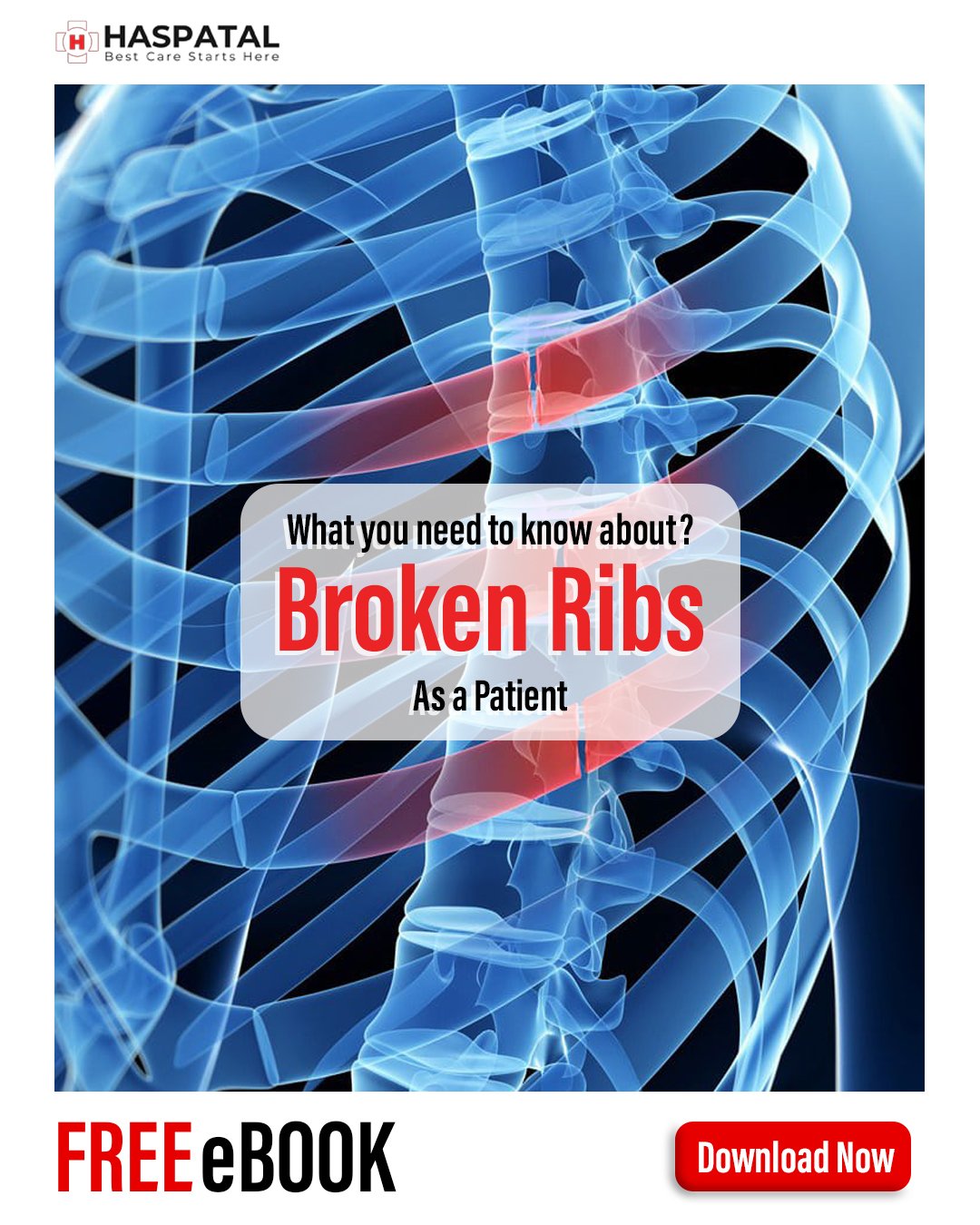 How Broken Ribs Can Affect Your Body Haspatal Online Consultation App Haspatal｜easy Access To 0923