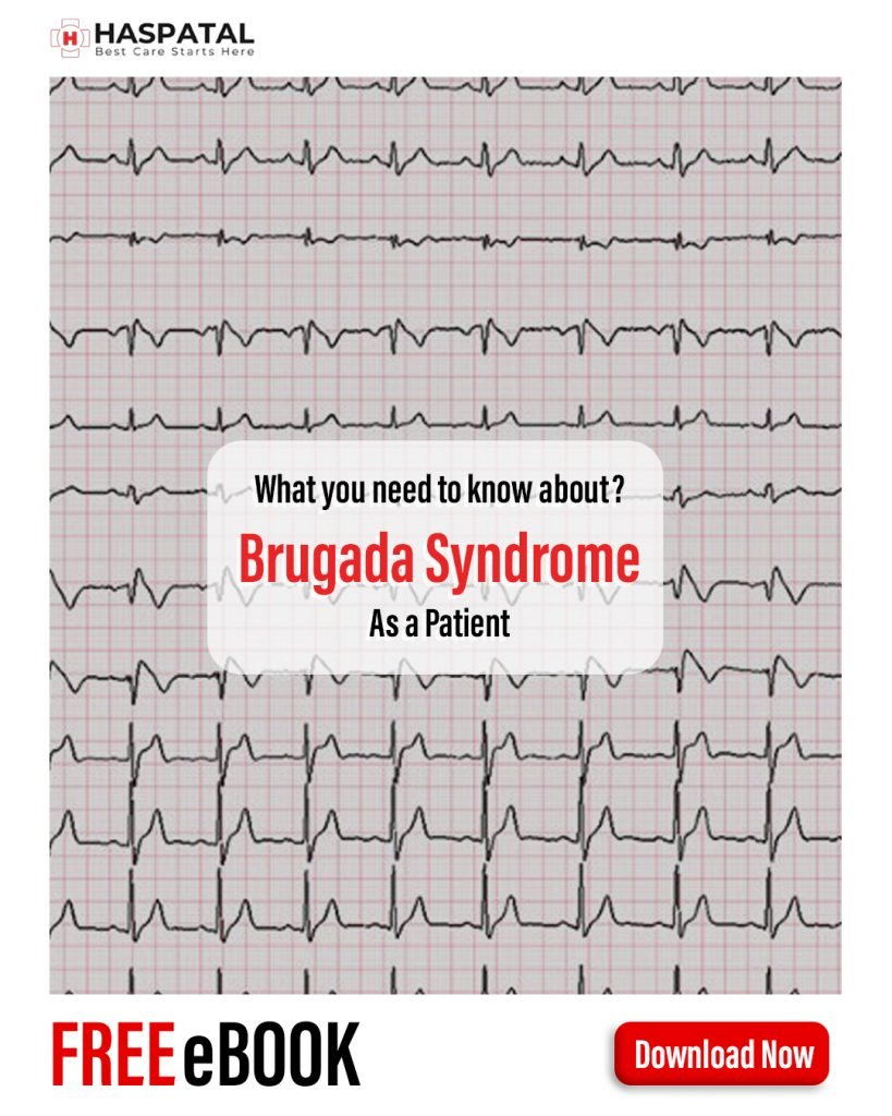 How brugada syndrome can affect your health? Haspatal online doctor consultation app