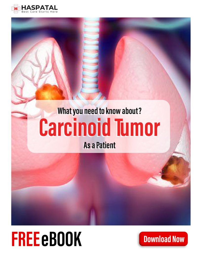 How carcinoid tumor can affect your health? Haspatal online doctor consultation app.