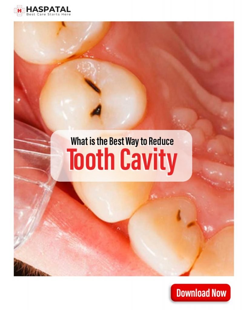 What is the best way to reduce tooth cavity? Haspatal online doctor consultation app.